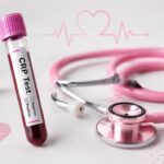 Povišen CRP: šta znače vrijednosti 10, 50, 100 i preko 200 mg/L?
