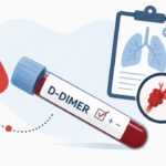 D-dimer povišen: šta znači i kada je razlog za zabrinutost?